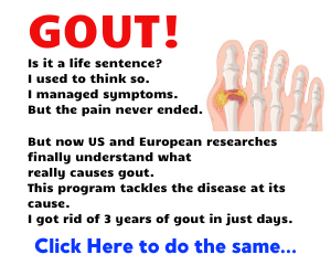  Gouty Arthritis Treatment